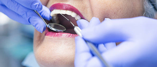 Best Emergency Wisdom Teeth Removal in Elim, PA